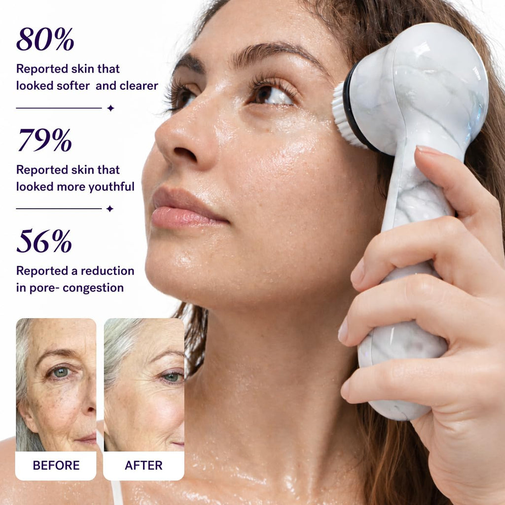 Beauty Soniclear Face Brush 2026 Allure Readers Choice Winner | Sonic Facial Cleansing (no rotating), Exfoliation Brush for Men/Women, Antimicrobial Protected, 4 speeds, Serum Infusion Head
